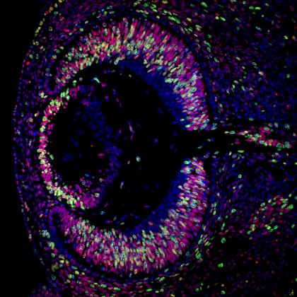 The developing mouse retina
