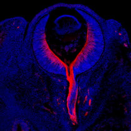 Developing Retinal Ganglion Cells (red) in the mouse retina